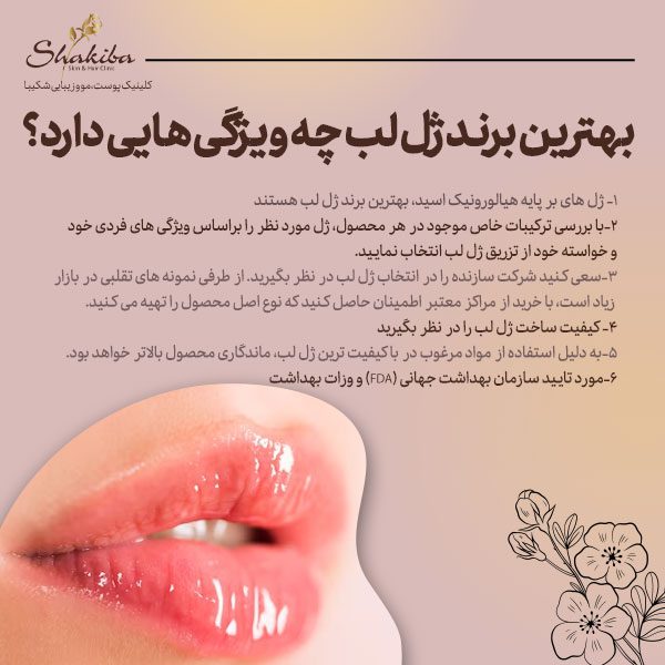 بهترین برند ژل لب