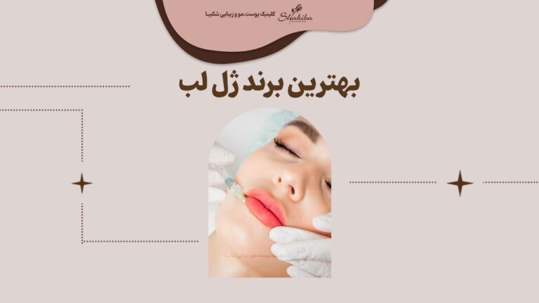 بهترین برند ژل لب کدام است