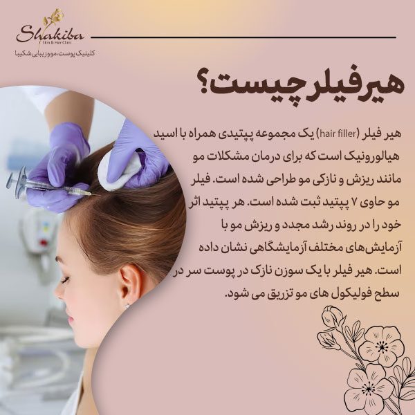 هیر فیلر چیست
