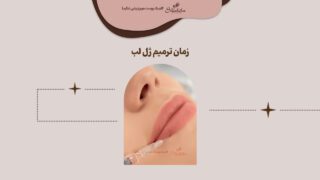 زمان ترمیم ژل لب کی است