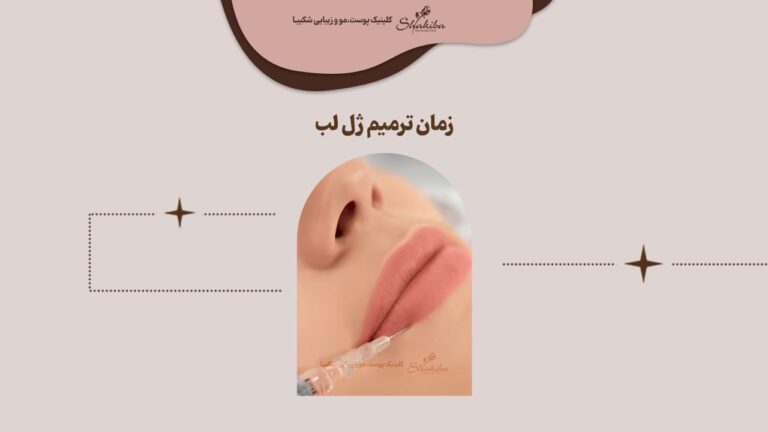 زمان ترمیم ژل لب کی است