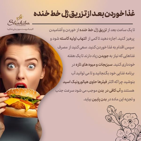 غذا خوردن بعد از تزریق ژل خط خنده