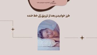 خوابیدن بعد از تزریق ژل خط خنده