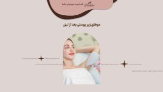 درمان موهای زیر پوستی بعد از لیزر