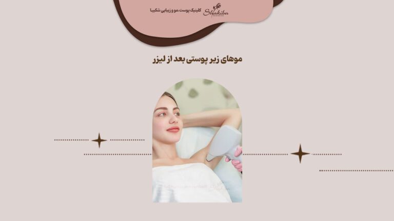 درمان موهای زیر پوستی بعد از لیزر