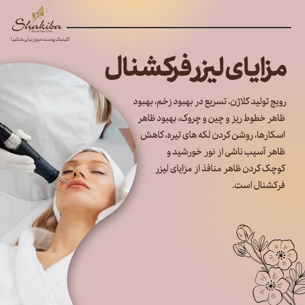 مزایای لیزر فرکشنال