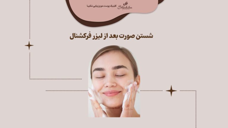 شستن صورت بعد از لیزر فرکشنال به چه صورت است
