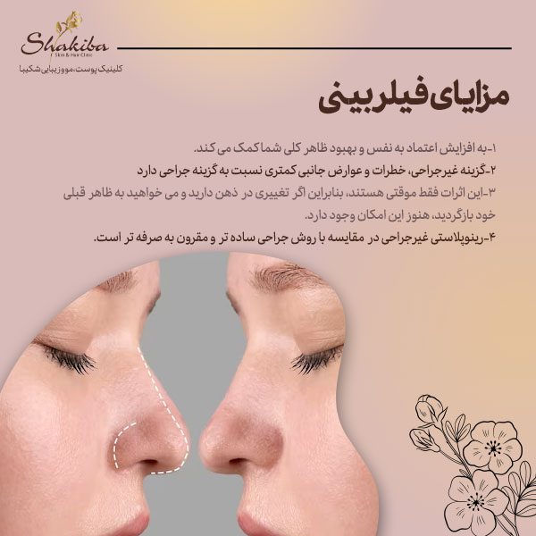 مزایای فیلر بینی