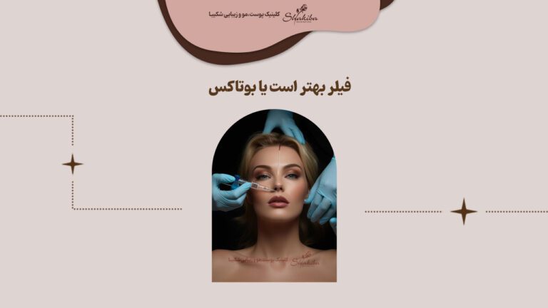 فیلر بهتره یا بوتاکس