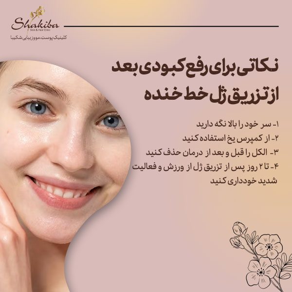 نکاتی برای رفع کبودی بعد از تزریق ژل خط خنده