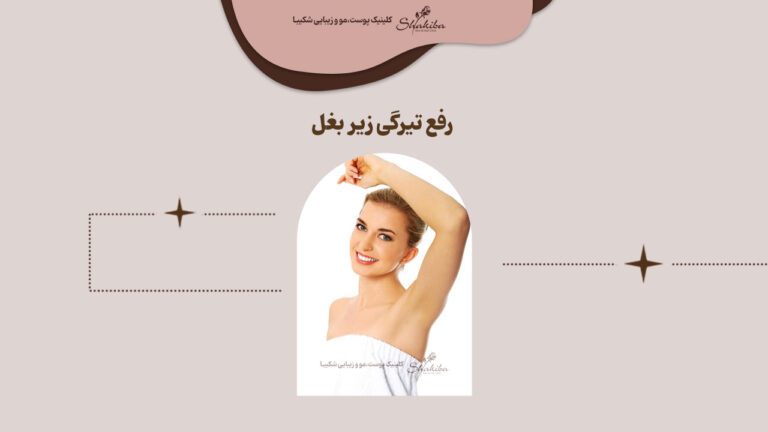 درمان و رفع تیرگی زیر بغل