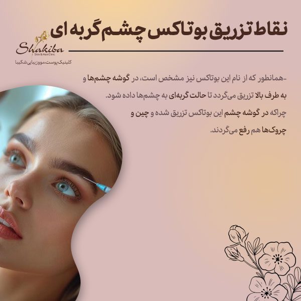 نقاط تزریق بوتاکس چشم گربه‌ای