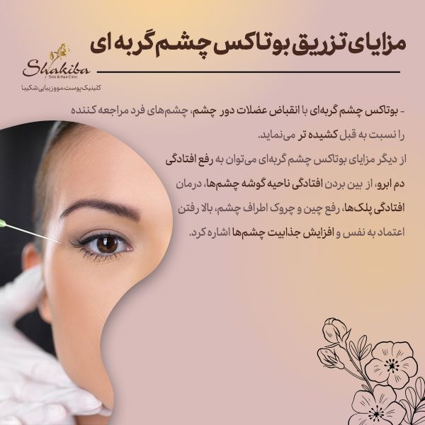 مزایای تزریق بوتاکس چشم گربه‌ای