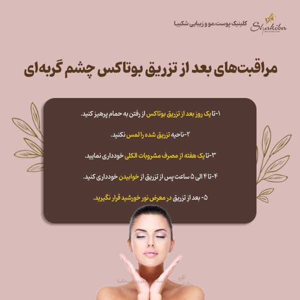 مراقبت‌های بعد از تزریق بوتاکس چشم گربه‌ای