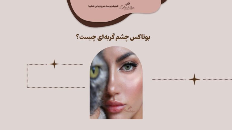 بوتاکس چشم گربه‌ای چیست