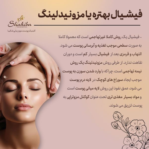 فیشیال بهتره یا مزونیدلینگ