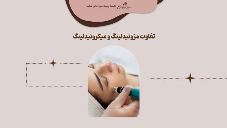 تفاوت مزونیدلینگ و میکرونیدلینگ چیست