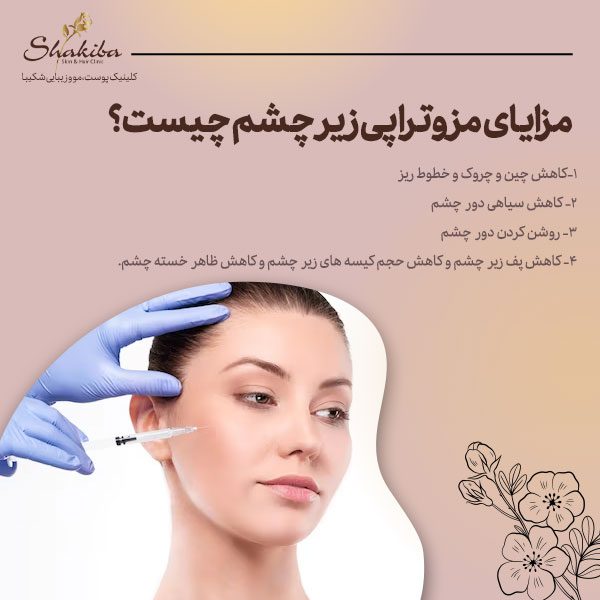 مزایای مزوتراپی زیر چشم