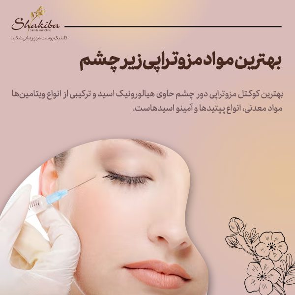 بهترین مواد مزوتراپی زیر چشم