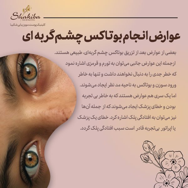 عوارض انجام بوتاکس چشم گربه‌ای