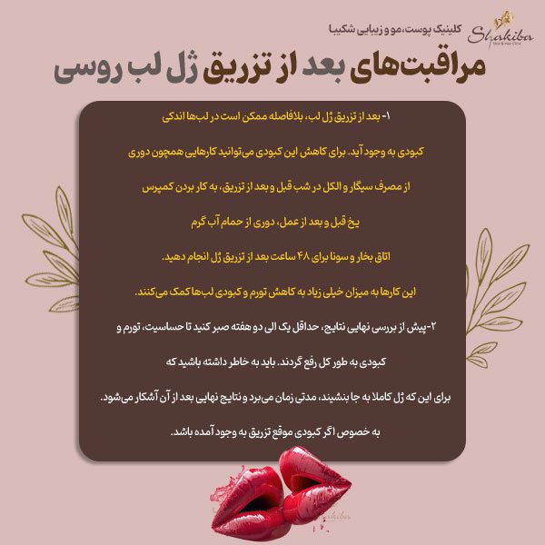 مراقبت‌های بعد از تزریق ژل لب روسی