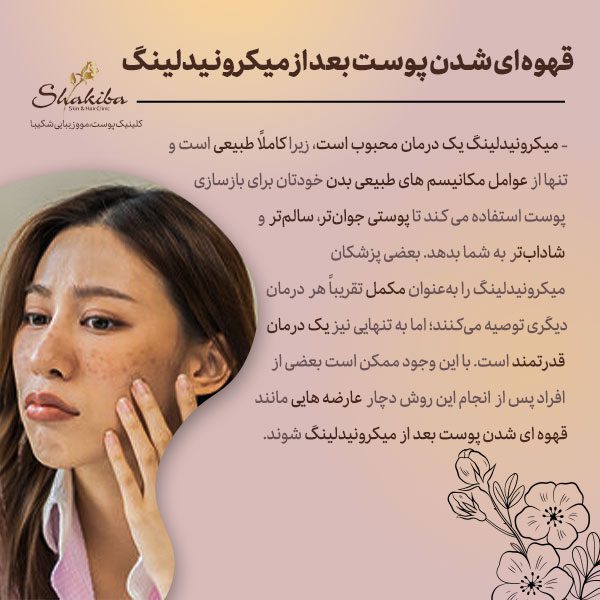 قهوه ای شدن پوست بعد از میکرونیدلینگ