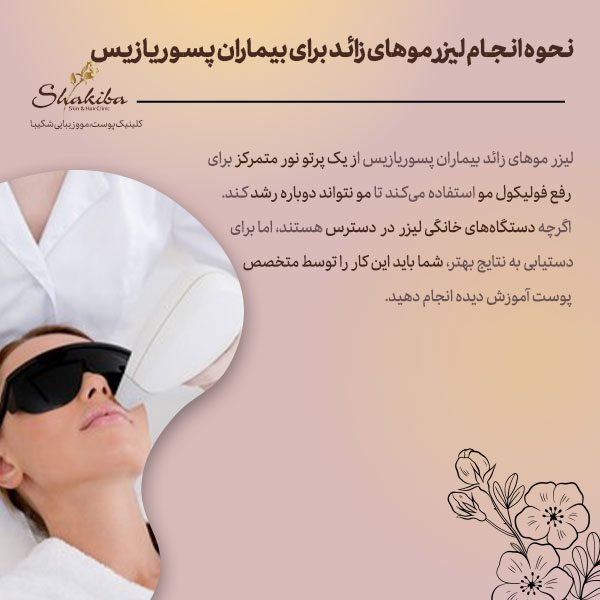  لیزر موهای زائد برای بیماران پسوریازیس