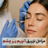 مراحل تزریق آنزیم برای زیر چشم